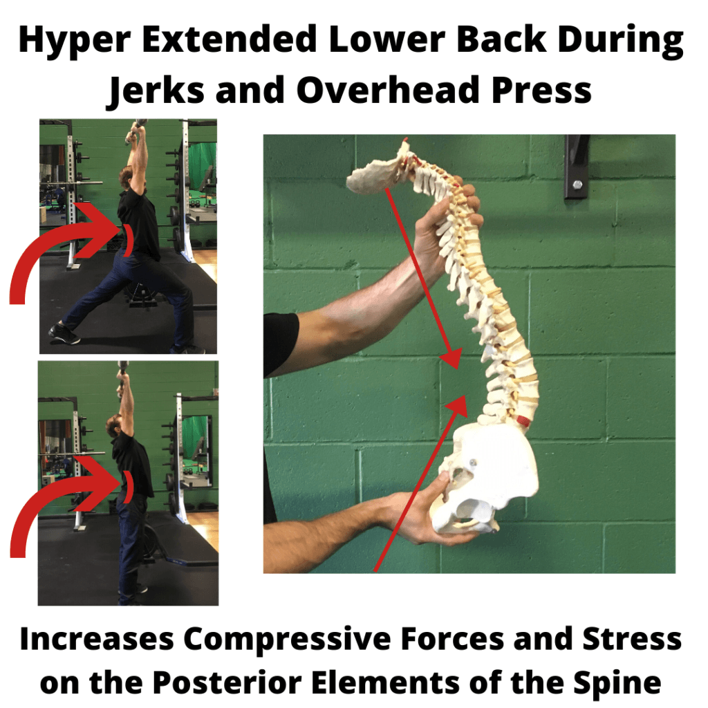 6 Causes of Extension Based Lower Back Pain in the Gym FITNESS PAIN FREE